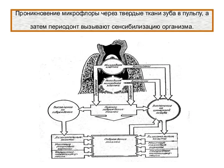 Проникновение микрофлоры через твердые ткани зуба в пульпу, а затем периодонт вызывают сенсибилизацию организма.