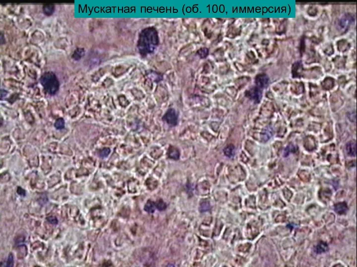 Мускатная печень (об. 100, иммерсия)