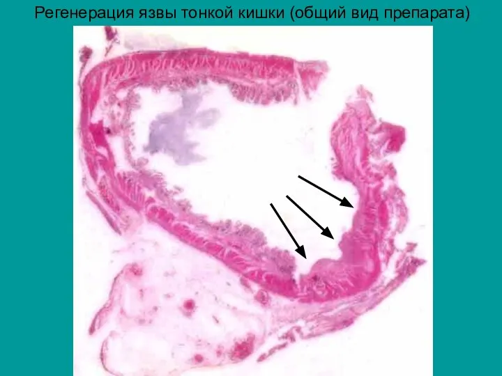 Регенерация язвы тонкой кишки (общий вид препарата)