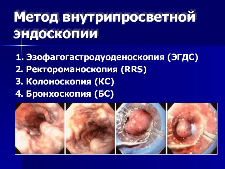 Метод внутрипросветной эндоскопии 1. Эзофагогастродуоденоскопия (ЭГДС) 2. Ректороманоскопия (RRS) 3. Колоноскопия (КС) 4. Бронхоскопия (БС)