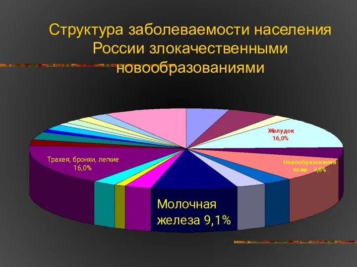 Структура заболеваемости населения России злокачественными новообразованиями