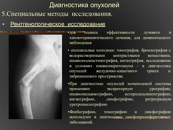 Диагностика опухолей 5.Специальные методы исследования. Рентгенологическое исследование для оценки эффективности лучевого