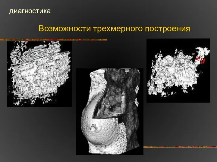 Возможности трехмерного построения диагностика