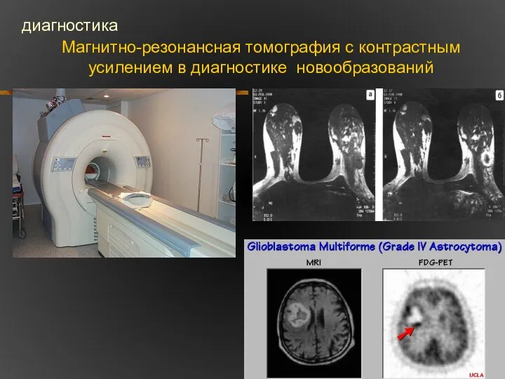 Магнитно-резонансная томография с контрастным усилением в диагностике новообразований диагностика
