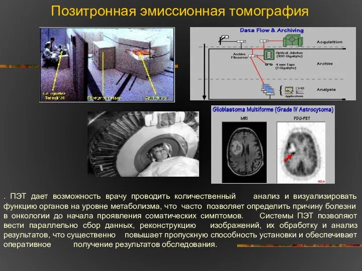 Позитронная эмиссионная томография . ПЭТ дает возможность врачу проводить количественный анализ