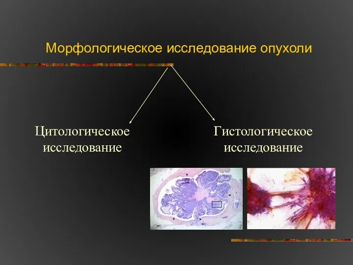 Морфологическое исследование опухоли Цитологическое исследование Гистологическое исследование