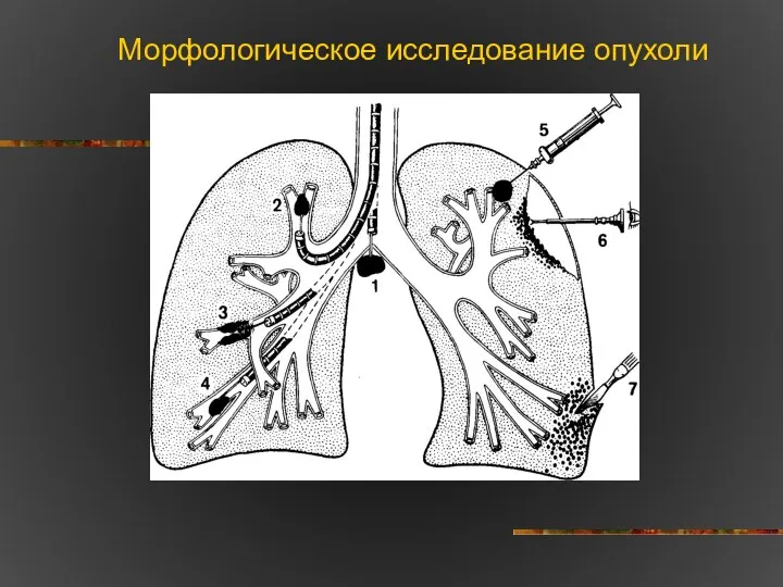 Морфологическое исследование опухоли