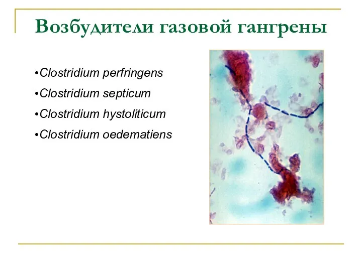 Возбудители газовой гангрены Clostridium perfringens Clostridium septicum Clostridium hystoliticum Clostridium oedematiens