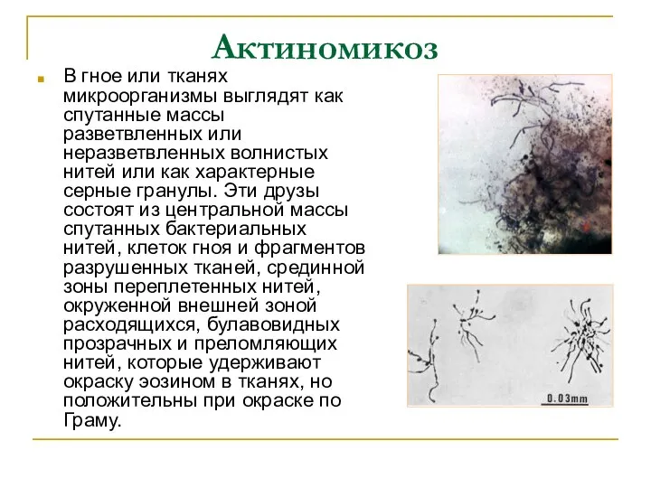 Актиномикоз В гное или тканях микроорганизмы выглядят как спутанные массы разветвленных