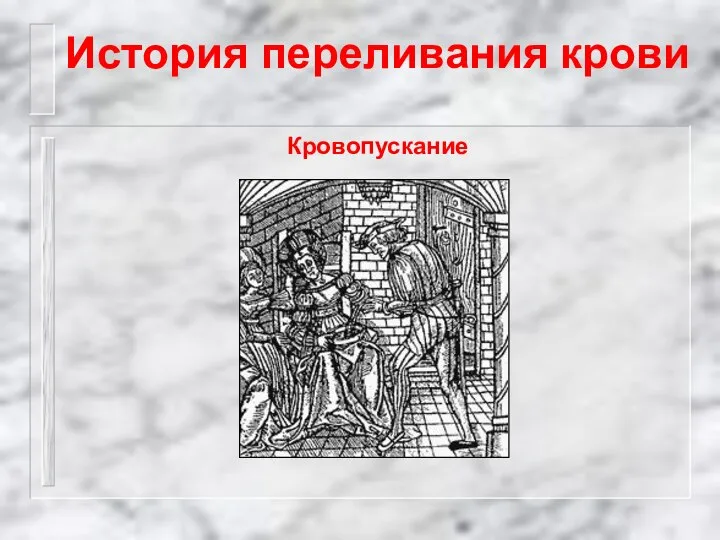 История переливания крови Кровопускание