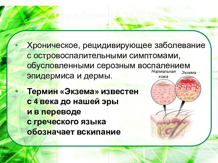 Определение ЭКЗЕМЫ Хроническое, рецидивирующее заболевание с островоспалительными симптомами, обусловленными серозным воспалением