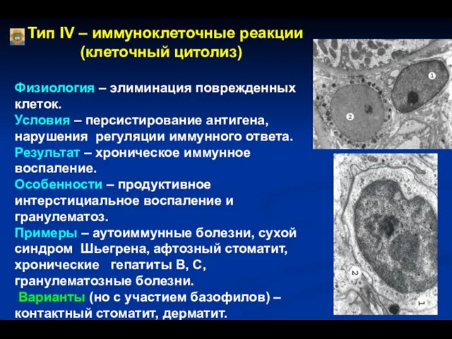 Тип IV – иммуноклеточные реакции (клеточный цитолиз) Физиология – элиминация поврежденных
