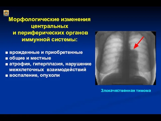 Морфологические изменения центральных и периферических органов иммунной системы: ■ врожденные и