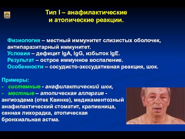 Примеры: - системные - анафилактический шок, - местные – атопическая аллергия