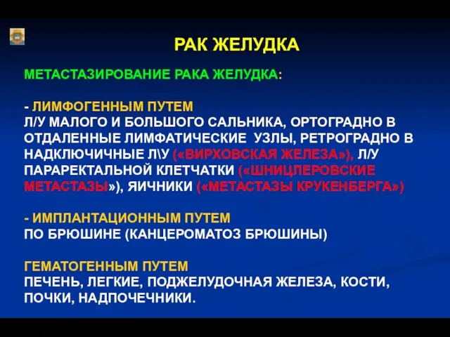 РАК ЖЕЛУДКА МЕТАСТАЗИРОВАНИЕ РАКА ЖЕЛУДКА: - ЛИМФОГЕННЫМ ПУТЕМ Л/У МАЛОГО И