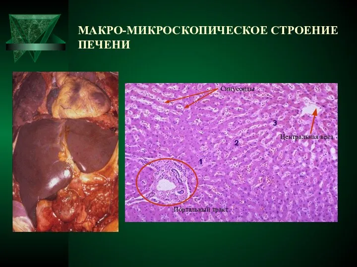 МАКРО-МИКРОСКОПИЧЕСКОЕ СТРОЕНИЕ ПЕЧЕНИ Портальный тракт Центральная вена Синусоиды