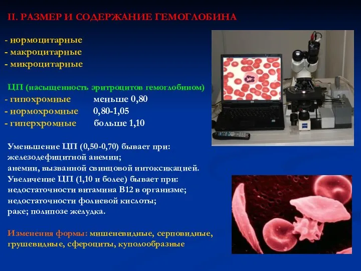 II. РАЗМЕР И СОДЕРЖАНИЕ ГЕМОГЛОБИНА нормоцитарные макроцитарные микроцитарные ЦП (насыщенность эритроцитов