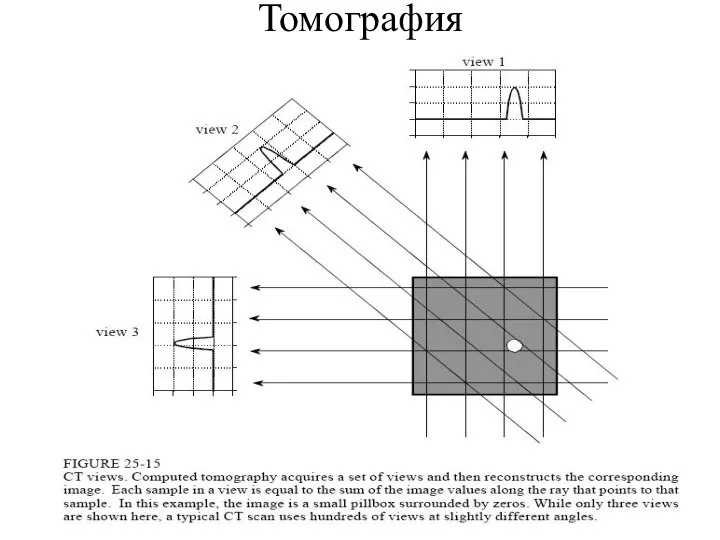 Томография