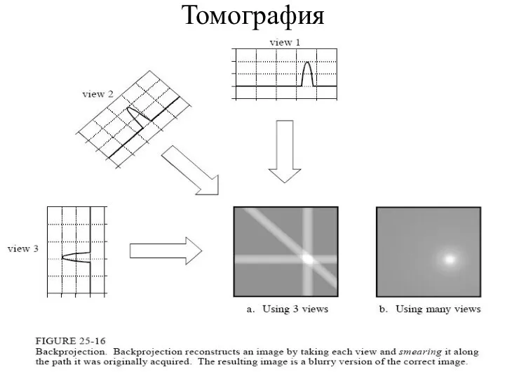 Томография