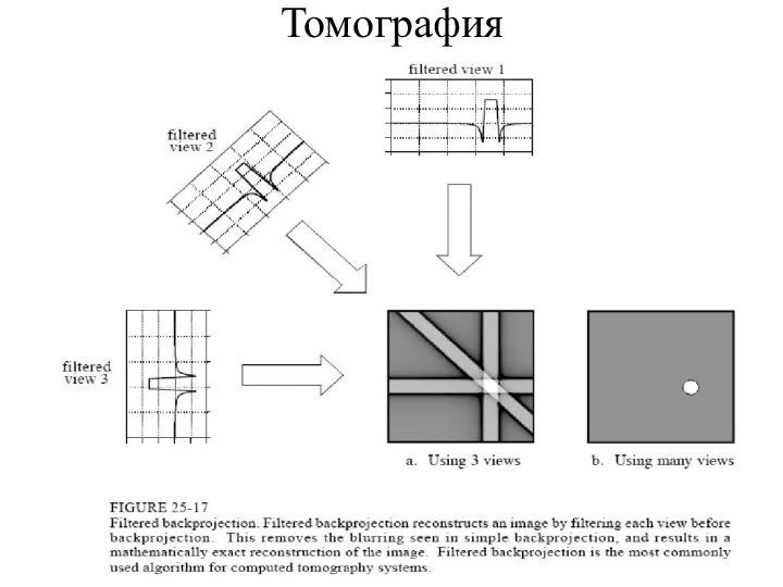 Томография