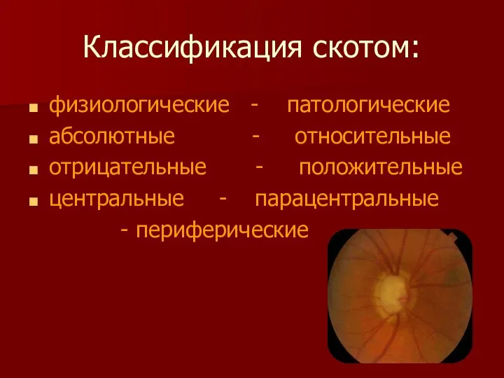 Классификация скотом: физиологические - патологические абсолютные - относительные отрицательные - положительные центральные - парацентральные - периферические