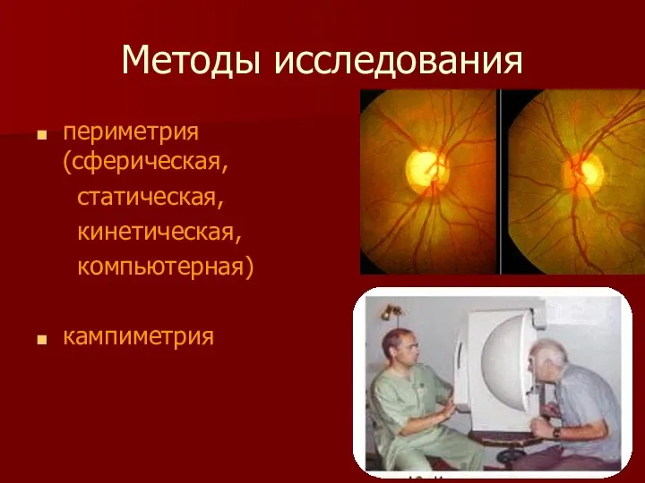 Методы исследования периметрия (сферическая, статическая, кинетическая, компьютерная) кампиметрия