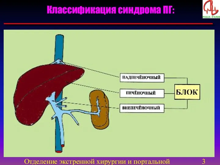 Отделение экстренной хирургии и портальной гипертензии Классификация синдрома ПГ: