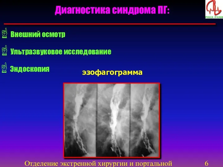 Отделение экстренной хирургии и портальной гипертензии Диагностика синдрома ПГ: Ультразвуковое исследование Внешний осмотр Эндоскопия эзофагограмма