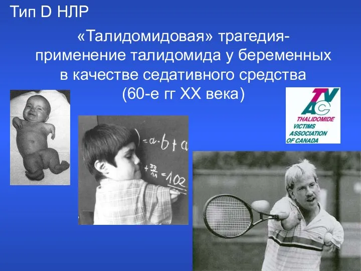 «Талидомидовая» трагедия- применение талидомида у беременных в качестве седативного средства (60-е