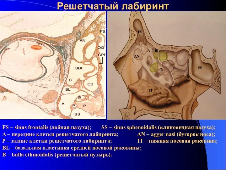 Решетчатый лабиринт FS AN A B P BL SS IT FS