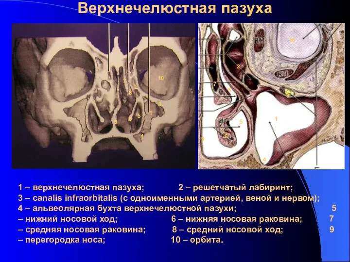 Верхнечелюстная пазуха 1 1 2 2 3 3 4 4 5