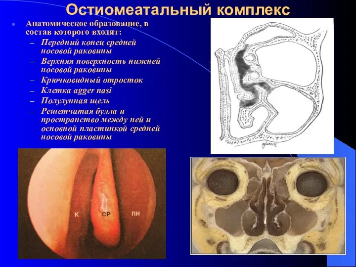 Остиомеатальный комплекс Анатомическое образование, в состав которого входят: Передний конец средней