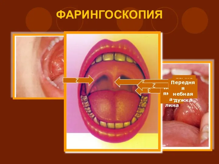 ФАРИНГОСКОПИЯ 2