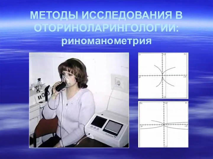 МЕТОДЫ ИССЛЕДОВАНИЯ В ОТОРИНОЛАРИНГОЛОГИИ: риноманометрия