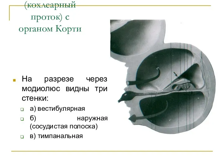 Перепончатая улитка (кохлеарный проток) с органом Корти На разрезе через модиолюс