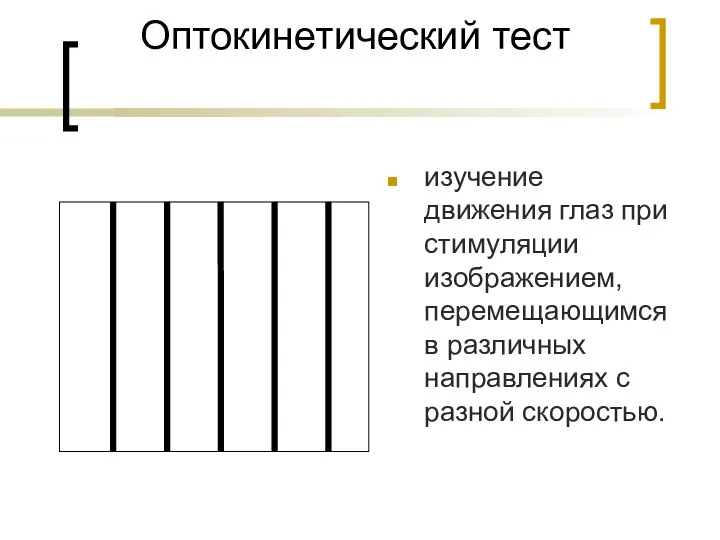 Оптокинетический тест изучение движения глаз при стимуляции изображением, перемещающимся в различных направлениях с разной скоростью.