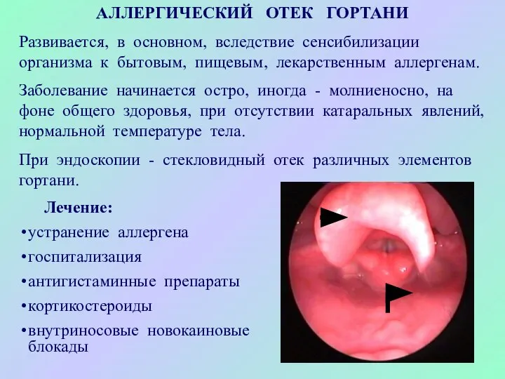 АЛЛЕРГИЧЕСКИЙ ОТЕК ГОРТАНИ Развивается, в основном, вследствие сенсибилизации организма к бытовым,