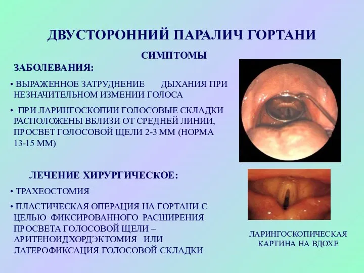 ДВУСТОРОННИЙ ПАРАЛИЧ ГОРТАНИ СИМПТОМЫ ЗАБОЛЕВАНИЯ: ВЫРАЖЕННОЕ ЗАТРУДНЕНИЕ ДЫХАНИЯ ПРИ НЕЗНАЧИТЕЛЬНОМ ИЗМЕНИИ