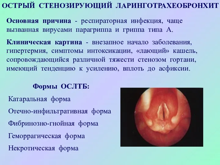 ОСТРЫЙ СТЕНОЗИРУЮЩИЙ ЛАРИНГОТРАХЕОБРОНХИТ Основная причина - респираторная инфекция, чаще вызванная вирусами