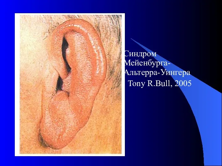 Синдром Мейенбурга-Альтерра-Уингера Tony R.Bull, 2005