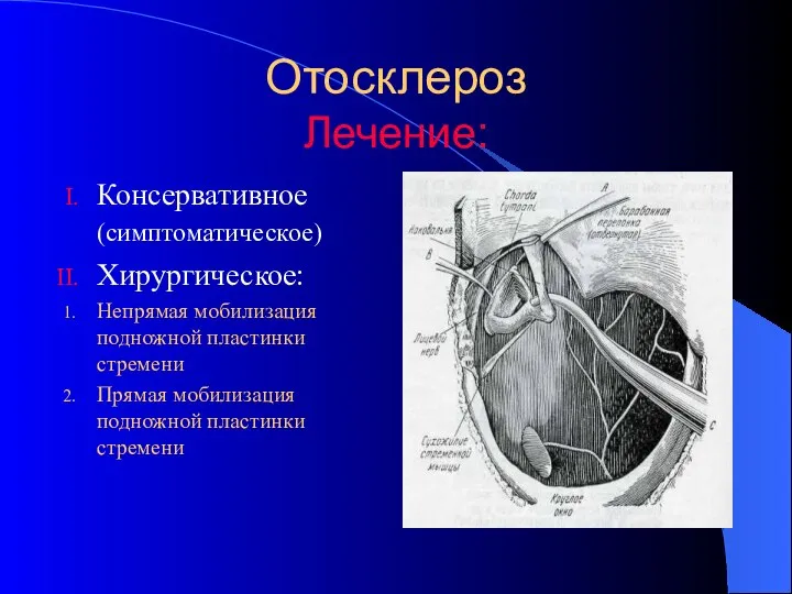 Отосклероз Лечение: Консервативное (симптоматическое) Хирургическое: Непрямая мобилизация подножной пластинки стремени Прямая мобилизация подножной пластинки стремени