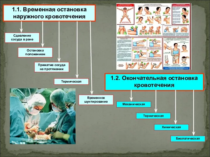 1.1. Временная остановка наружного кровотечения Сдавление сосуда в ране Остановка положением