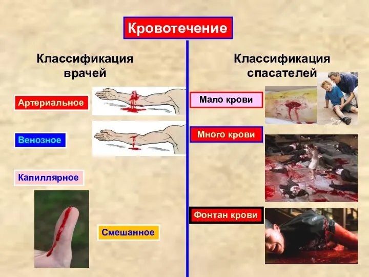 Кровотечение Венозное Артериальное Смешанное Капиллярное Классификация спасателей Классификация врачей Мало крови Фонтан крови Много крови