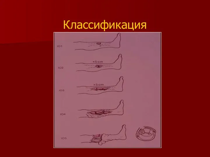 Классификация