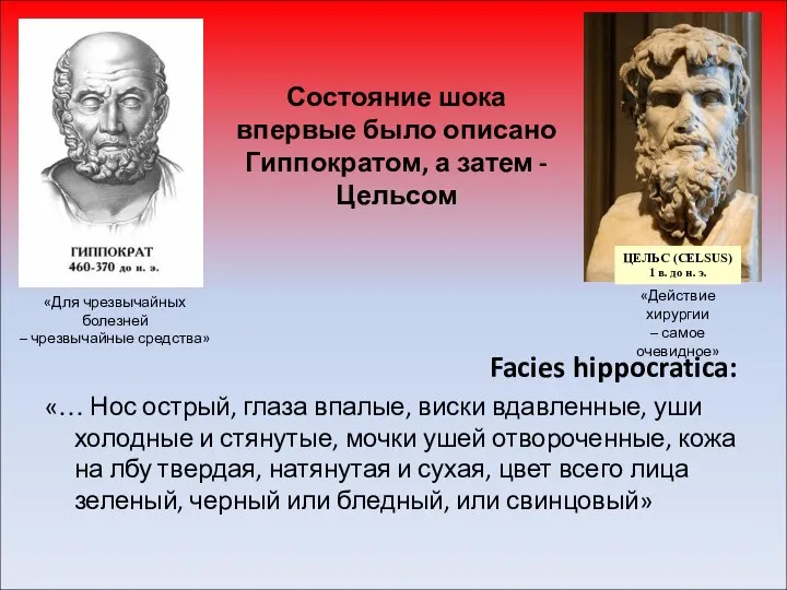 Состояние шока впервые было описано Гиппократом, а затем - Цельсом Facies