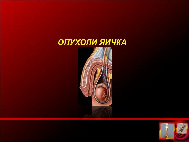 ОПУХОЛИ ЯИЧКА