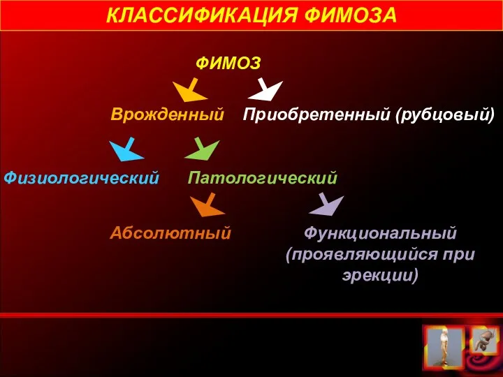 КЛАССИФИКАЦИЯ ФИМОЗА ФИМОЗ Врожденный Приобретенный (рубцовый) Физиологический Патологический Абсолютный Функциональный (проявляющийся при эрекции)