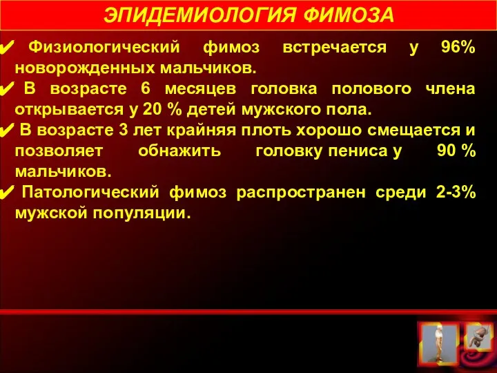 ЭПИДЕМИОЛОГИЯ ФИМОЗА Физиологический фимоз встречается у 96% новорожденных мальчиков. В возрасте