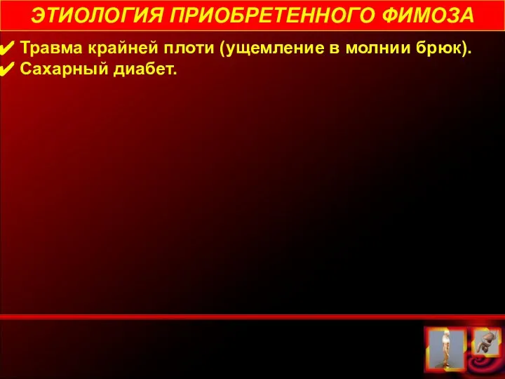 ЭТИОЛОГИЯ ПРИОБРЕТЕННОГО ФИМОЗА Травма крайней плоти (ущемление в молнии брюк). Сахарный диабет.