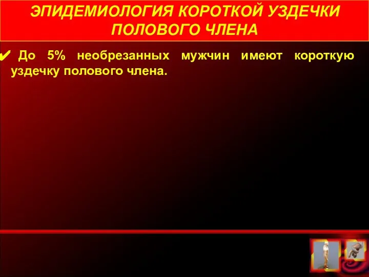 ЭПИДЕМИОЛОГИЯ КОРОТКОЙ УЗДЕЧКИ ПОЛОВОГО ЧЛЕНА До 5% необрезанных мужчин имеют короткую уздечку полового члена.